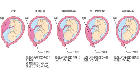 胎盤形成時期|胎盤（たいばん）とは？位置や重さは？完成はいつ？。